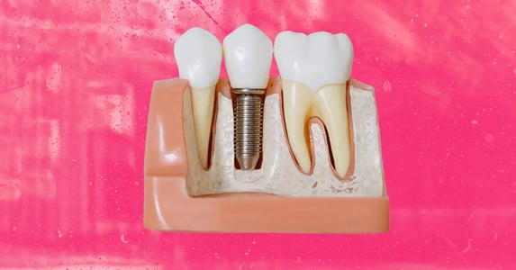 teeth